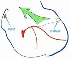 有一点动心电影抢版